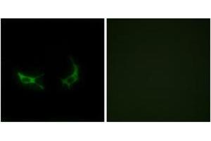 Immunofluorescence analysis of LOVO cells, using OR2M3 Antibody. (OR2M3 anticorps  (AA 241-290))