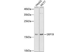 Western blot analysis of extracts of various cell lines, using SRP19 antibody (ABIN6129677, ABIN6148450, ABIN6148451 and ABIN6222484) at 1:1000 dilution.
