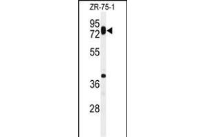 Western blot analysis of HAS1 Antibody (Center) (ABIN651121 and ABIN2840084) in ZR-75-1 cell line lysates (35 μg/lane). (HAS1 anticorps  (AA 166-193))
