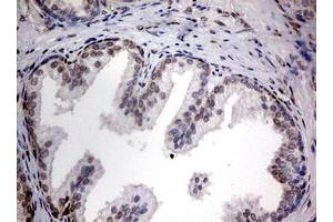 Image no. 6 for anti-TIA1 Cytotoxic Granule-Associated RNA Binding Protein (TIA1) antibody (ABIN1501387) (TIA1 anticorps)