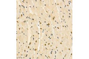 Immunohistochemistry of paraffin embedded mouse heart using ZNF106 (ABIN7076260) at dilution of 1:300 (400x lens)