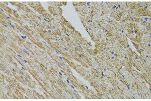 Immunohistochemistry of paraffin-embedded Mouse heart using FHIT Polyclonal Antibody at dilution of 1:100 (40x lens). (FHIT anticorps)