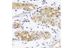 Immunohistochemistry of paraffin-embedded human stomach using NPPA antibody (ABIN5970781) at dilution of 1/200 (40x lens).
