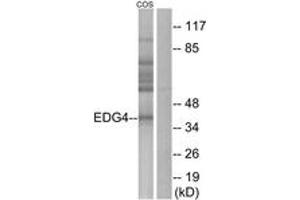 Western Blotting (WB) image for anti-Lysophosphatidic Acid Receptor 2 (LPAR2) (AA 271-320) antibody (ABIN2890816) (EDG4 anticorps  (AA 271-320))
