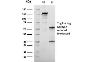 SDS-PAGE Analysis Purified Dystrophin Monospecific Mouse Monoclonal Antibody (DMD/3245). (Dystrophin anticorps  (AA 114-263))