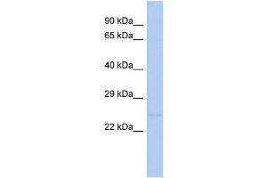 WB Suggested Anti-TNFRSF10C Antibody Titration:  0. (DcR1 anticorps  (N-Term))