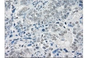 Immunohistochemical staining of paraffin-embedded colon tissue using anti-SLC7A8mouse monoclonal antibody. (SLC7A8 anticorps)