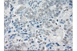 Immunohistochemical staining of paraffin-embedded colon tissue using anti-SLC7A8mouse monoclonal antibody.