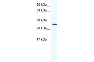 Western Blotting (WB) image for anti-Homeobox B1 (HOXB1) antibody (ABIN2461437) (HOXB1 anticorps)
