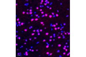 Immunofluorescence of paraffin embedded rat brain using rap1 (ABIN7075857) at dilution of 1: 2000 (400x lens)