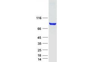 Validation with Western Blot
