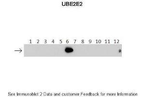 Lanes:   1: 40ng HIS-UBE2D1 protein 2: 40ng HIS-UBE2D2 protein 3: 40ng HIS-UBE2D3 protein 4: 40ng HIS-UBE2D4 protein 5: 40ng HIS-UBE2E1 protein 6: 40ng HIS-UBE2E2 protein 7: 40ng HIS-UBE2E3 protein 8: 40ng HIS-UBE2K protein 9: 40ng HIS-UBE2L3 protein 10: 40ng HIS-UBE2N protein 11: 40ng HIS-UBE2V1 protein 12: 40ng HIS-UBE2V2 protein.