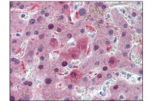 anti-Glutathione S-Transferase alpha 1 (GSTA1) (AA 1-222) antibody