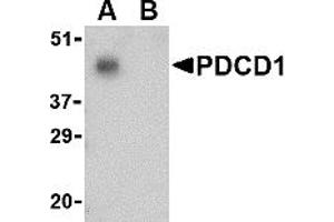 Western Blotting (WB) image for anti-Programmed Cell Death 1 (PDCD1) (C-Term) antibody (ABIN1030570)
