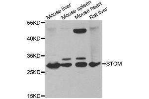 Western blot analysis of extracts of various tissues, using STOM antibody. (Stomatin anticorps)