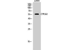 Western Blot (WB) analysis of 22RV1 cells using CYP2A7 Polyclonal Antibody.