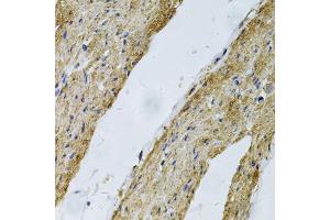 Immunohistochemistry of paraffin-embedded human smooth muscle using VCL Antibody (ABIN5970881) at dilution of 1/100 (40x lens). (Vinculin anticorps)