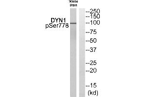 Western blot analysis of extracts from Mouse brain cells, using DYN1 (Phospho-Ser778) antibody. (Dynamin 1 anticorps  (pSer778))