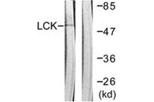 Western blot analysis of extracts from Jurkat cells, using Lck (Ab-192) Antibody. (LCK anticorps  (AA 161-210))