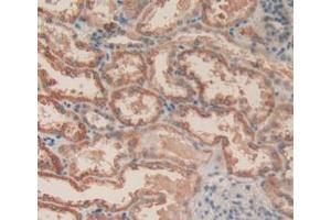 Figure. (Caspase 3 anticorps  (AA 29-175))