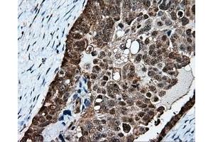 Immunohistochemical staining of paraffin-embedded Kidney tissue using anti-PSMC3 mouse monoclonal antibody. (PSMC3 anticorps)