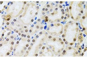Immunohistochemistry of paraffin-embedded Rat kidney using POP4 Polyclonal Antibody at dilution of 1:100 (40x lens). (RPP29 anticorps)