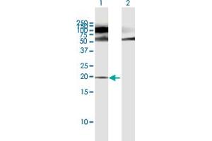 Western Blot analysis of POMP expression in transfected 293T cell line by POMP MaxPab polyclonal antibody. (POMP anticorps  (AA 1-141))