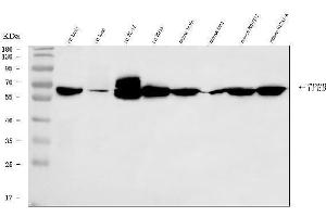Western blot analysis of TFEB using anti-TFEB antibody (ABIN7600648).