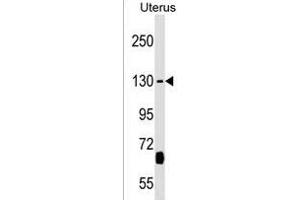 KIF27 Antibody (C-term) (ABIN1536712 and ABIN2838099) western blot analysis in Uterus tissue lysates (35 μg/lane). (KIF27 anticorps  (C-Term))