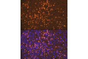 Immunofluorescence analysis of human spleen using Neutrophil Elastase (ELANE) Rabbit mAb (ABIN7266912) at dilution of 1:100 (40x lens). (ELANE anticorps)