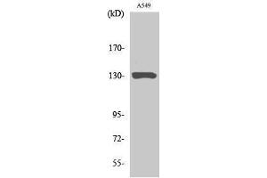 Western Blotting (WB) image for anti-Janus Kinase 1 (JAK1) (Ser639) antibody (ABIN3175726) (JAK1 anticorps  (Ser639))
