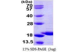 SDS-PAGE (SDS) image for GSK3B interacting protein (GSKIP) (AA 1-139) protein (His tag) (ABIN667415) (GSKIP Protein (AA 1-139) (His tag))