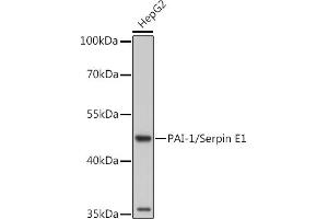 Western blot analysis of extracts of Rat placenta, using PAI-1/Serpin E1 antibody (ABIN6131330, ABIN6147601, ABIN6147603 and ABIN6221802) at 1:1000 dilution. (PAI1 anticorps  (AA 24-402))