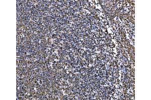 IHC analysis of MRE11 using anti-MRE11 antibody (ABIN7601056). (Mre11 anticorps  (AA 278-498))