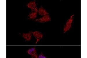 Confocal immunofluorescence analysis of HeLa cells using RPL23A Polyclonal Antibody at dilution of 1:100.