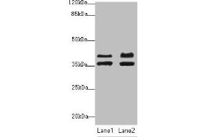 Western blot All lanes: IKBIPantibody at 2. (IKbIP anticorps  (AA 121-350))