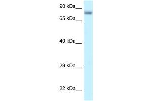 WB Suggested Anti-PPP6R3 Antibody Titration: 1. (PPP6R3 anticorps  (C-Term))