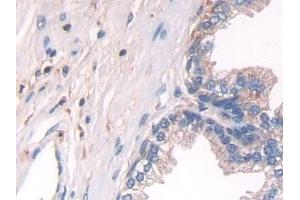 Detection of IL10 in Human Prostate Tissue using Polyclonal Antibody to Interleukin 10 (IL10) (IL-10 anticorps  (AA 19-178))