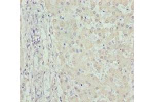 Immunohistochemistry of paraffin-embedded human liver tissue using ABIN7149965 at dilution of 1:100 (FMO5 anticorps  (AA 1-285))