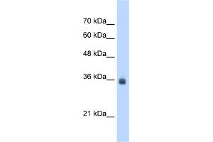 WB Suggested Anti-SDF4 Antibody Titration:  2. (SDF4 anticorps  (C-Term))