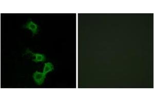 Immunofluorescence analysis of MCF7 cells, using Dab1 (Ab-232) Antibody.