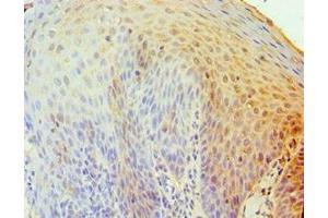 Immunohistochemistry of paraffin-embedded human tonsil tissue using ABIN7173838 at dilution of 1:100