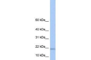 WB Suggested Anti-LOC284009 Antibody Titration: 0. (LOC284009 anticorps  (N-Term))