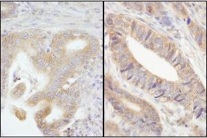 Immunohistochemistry (IHC) image for anti-Protein Tyrosine Phosphatase G1 (PTPN12) (AA 760-780) antibody (ABIN7453765)