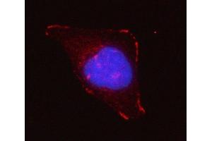 IF analysis of Grancalcin/GCA using anti-Grancalcin/GCA antibody (ABIN6719568). (Grancalcin anticorps  (AA 42-217))