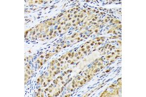 Immunohistochemistry of paraffin-embedded rat ovary using FKBP51/FKBP5 Rabbit mAb (ABIN7267213) at dilution of 1:100 (40x lens). (FKBP5 anticorps)
