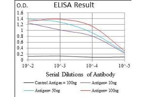 Black line: Control Antigen (100 ng), Purple line: Antigen(10 ng), Blue line: Antigen (50 ng), Red line: Antigen (100 ng),