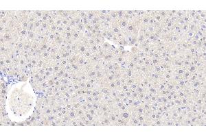 Detection of ADH1 in Mouse Liver Tissue using Polyclonal Antibody to Alcohol Dehydrogenase 1 (ADH1) (ADH1 anticorps  (AA 25-228))