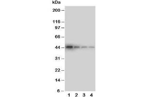 Western blot testing of DDR1 antibody and Lane 1:  recombinant human protein 10ng;  2: 5ng;  3: 2. (DDR1 anticorps  (C-Term))
