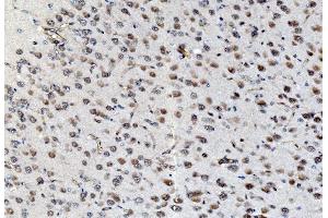 IHC analysis of PSMD8 using anti-PSMD8 antibody (ABIN7602571).